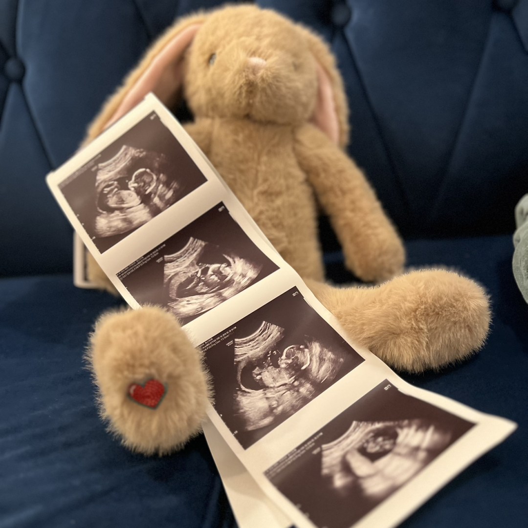 Photo shared by Allison for their Babylist baby registry.
