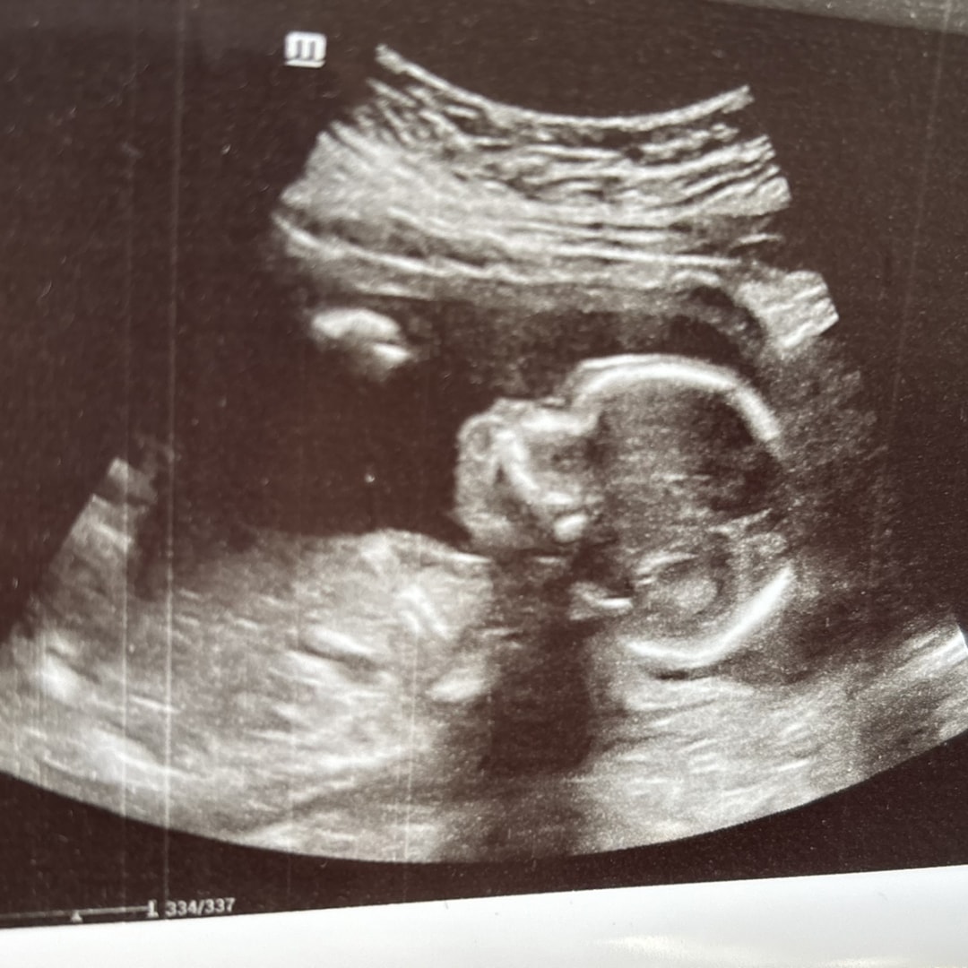 Photo shared by Yuliana for their Babylist baby registry.