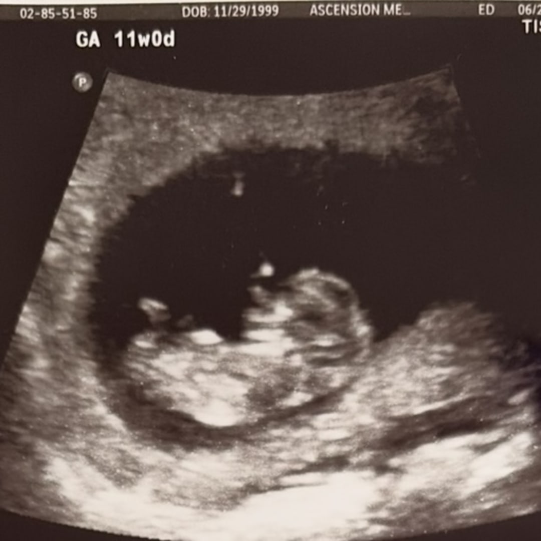 Photo shared by Alaina for their Babylist baby registry.