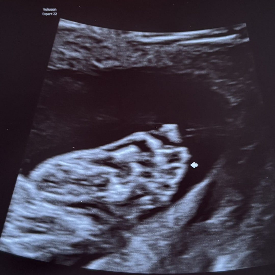 Photo shared by Michele for their Babylist baby registry.