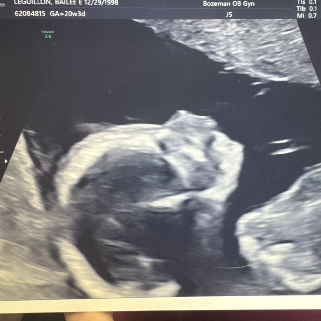 Photo shared by Bailee for their Babylist baby registry.