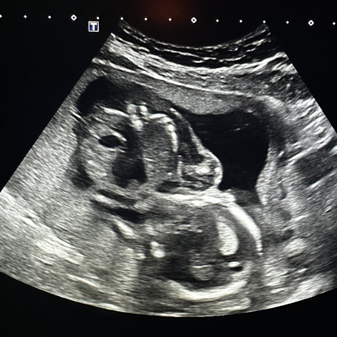 Photo shared by Kasaundra for their Babylist baby registry.