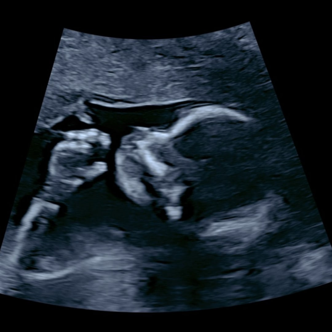 Photo shared by Ashley for their Babylist baby registry.
