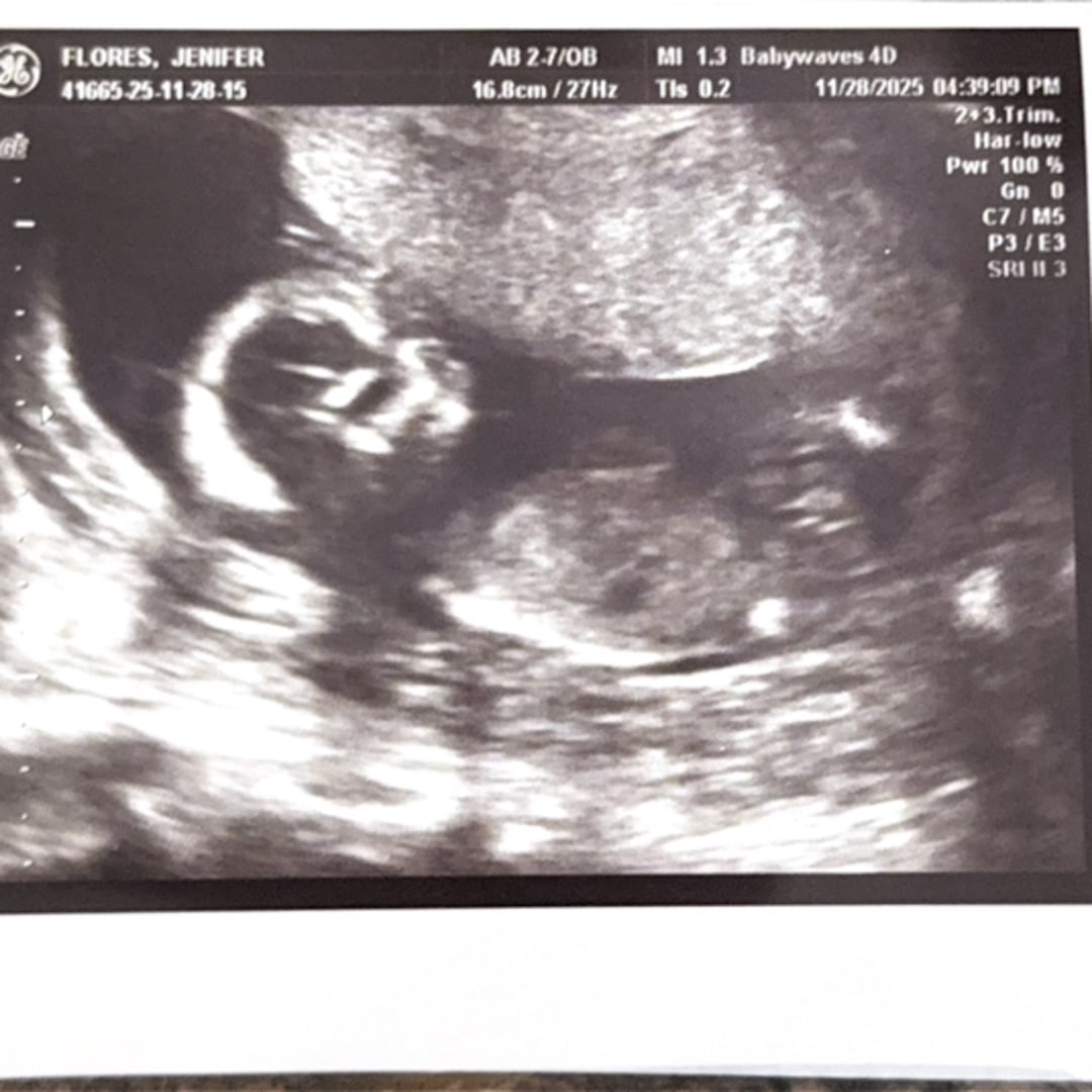 Photo shared by Bruce for their Babylist baby registry.