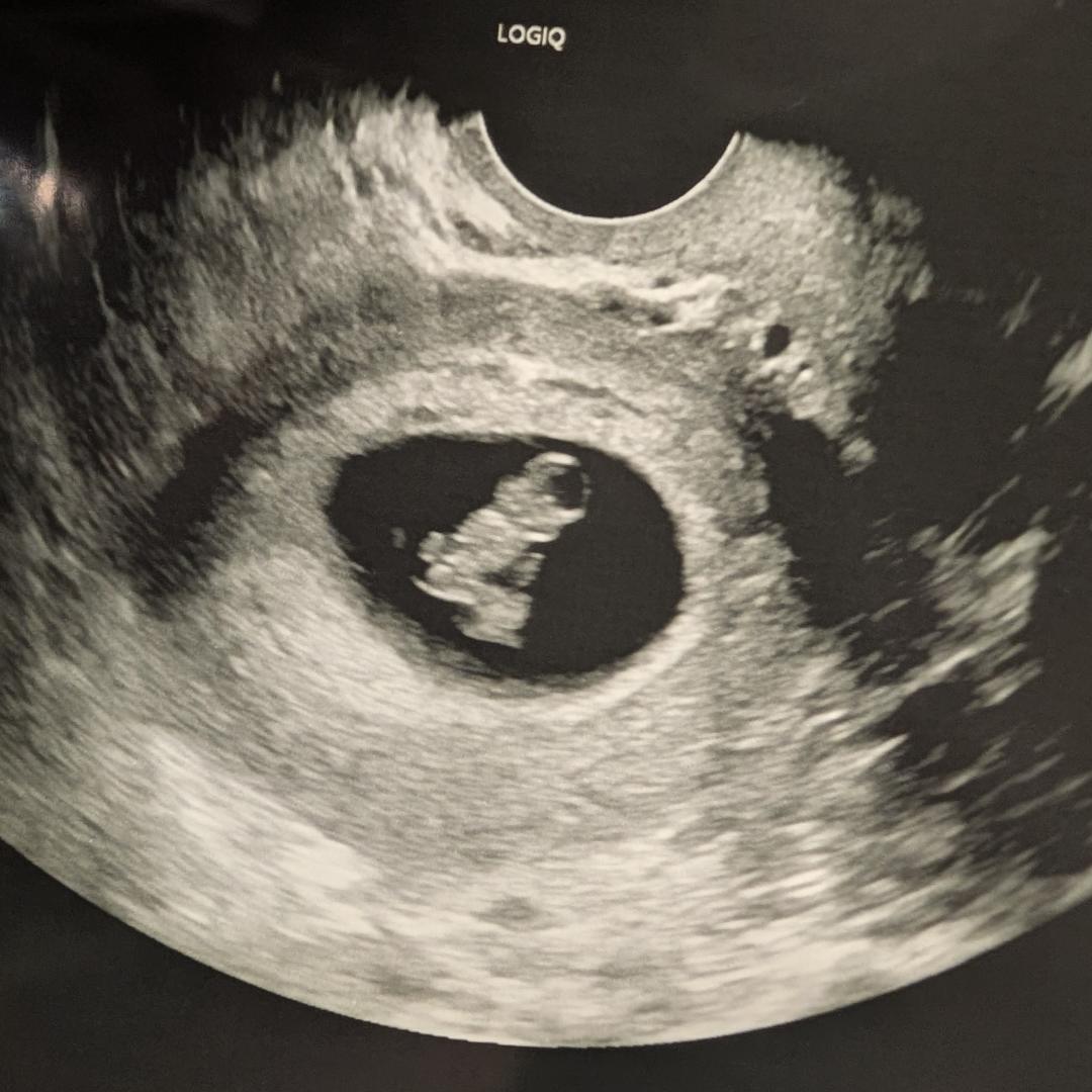 Photo shared by Christina for their Babylist baby registry.