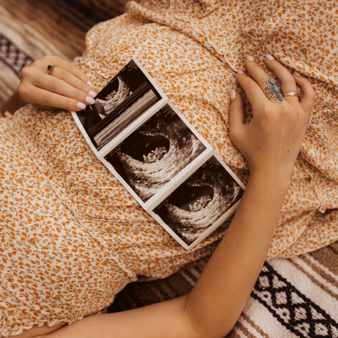 Photo shared by Lydia for their Babylist baby registry.