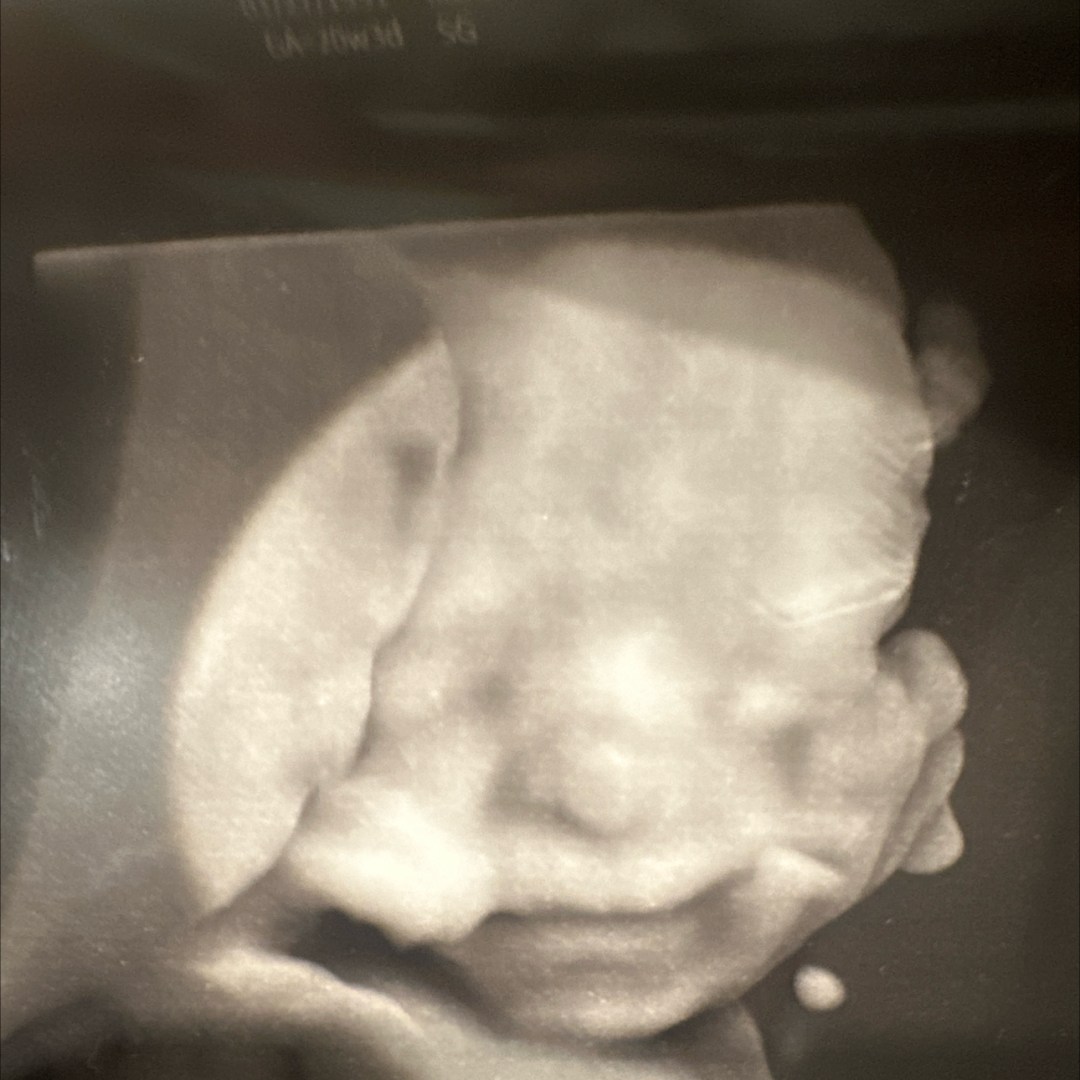 Photo shared by Anali for their Babylist baby registry.