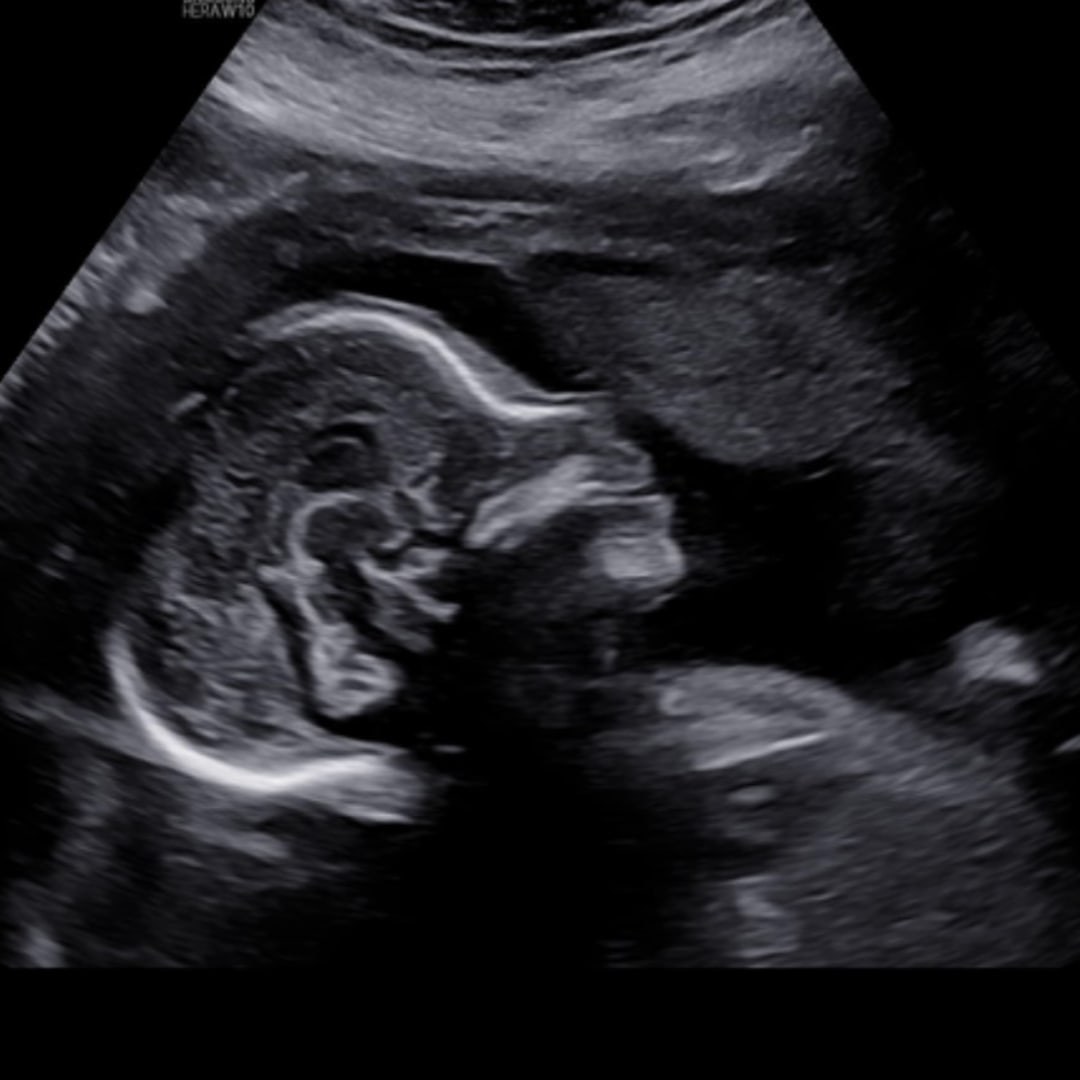 Photo shared by Dominique for their Babylist baby registry.