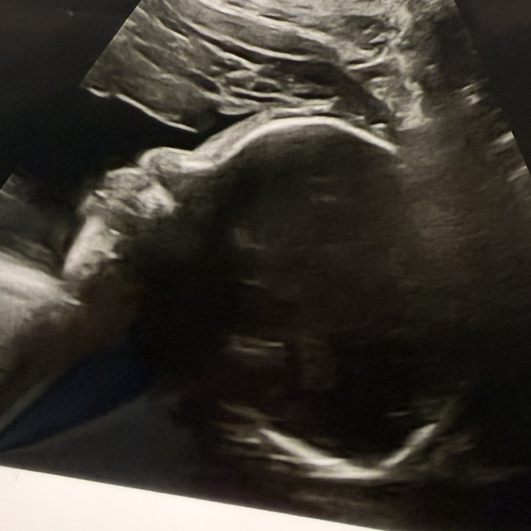 Photo shared by Shanthornie for their Babylist baby registry.