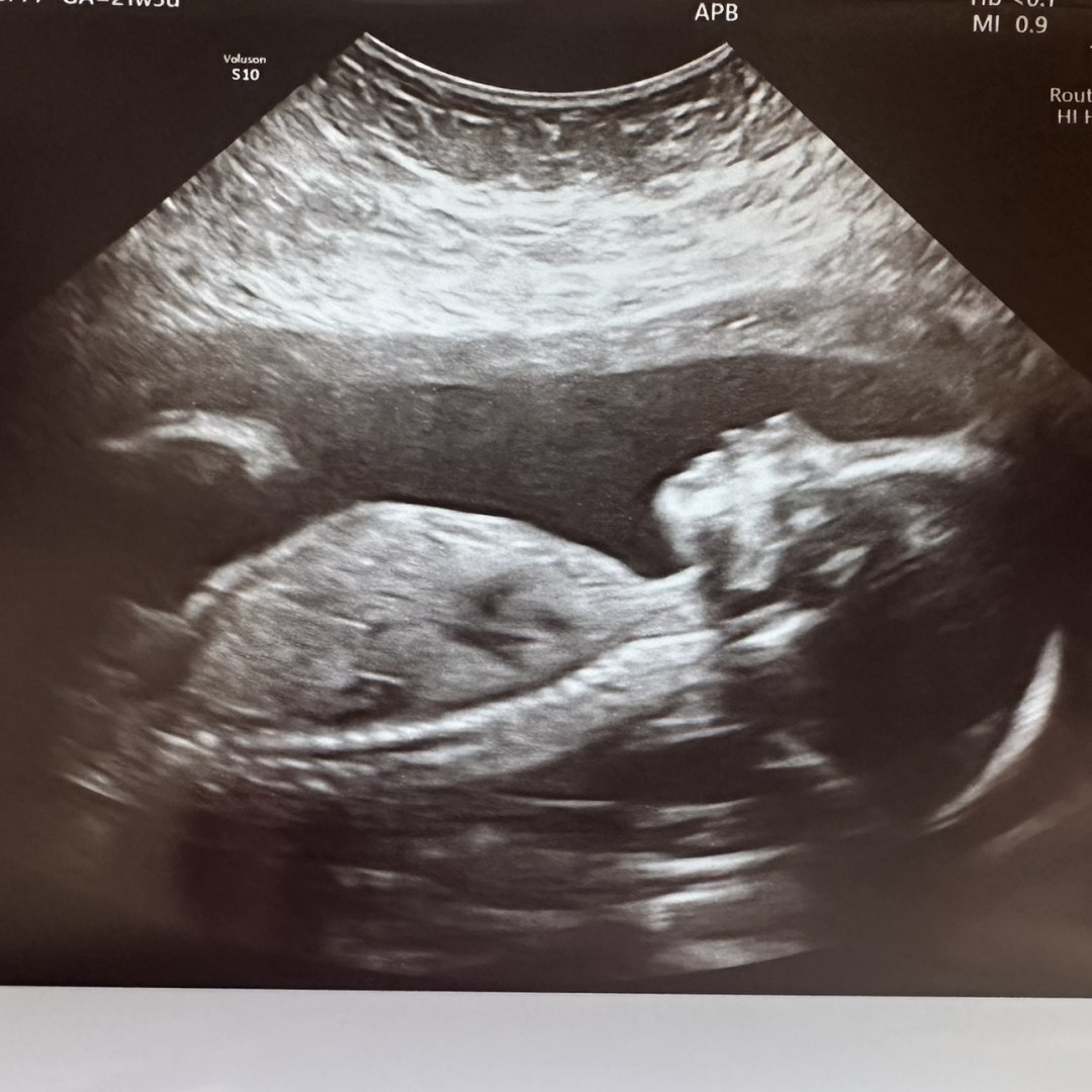 Photo shared by Ashley for their Babylist baby registry.