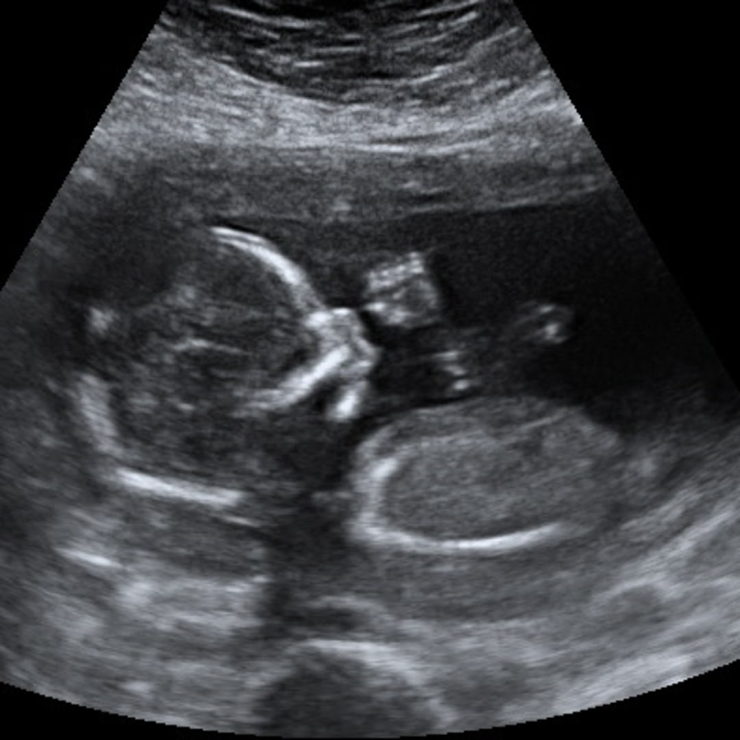 Photo shared by Andrew & Alyssa for their Babylist baby registry.