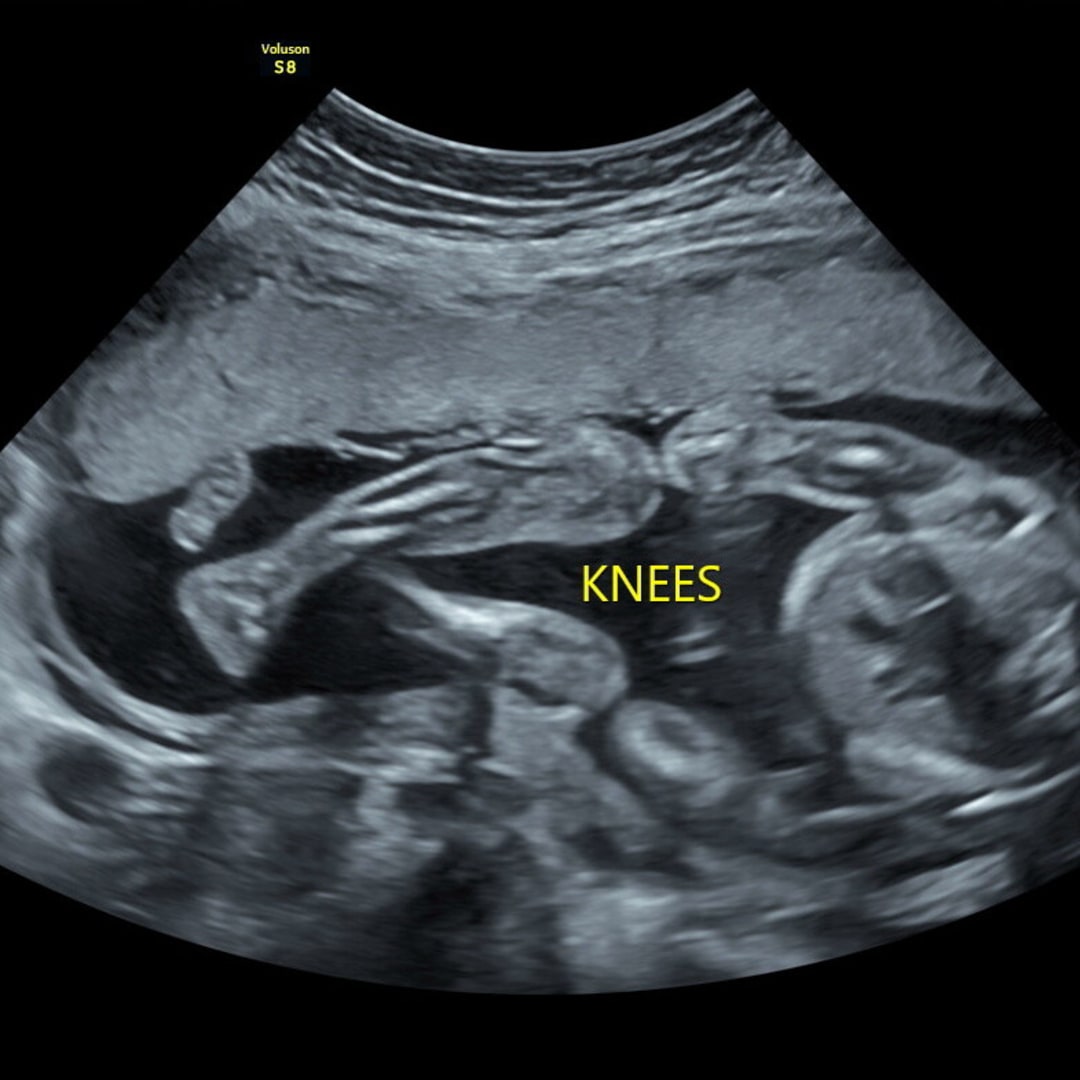 Photo shared by Kennedy for their Babylist baby registry.