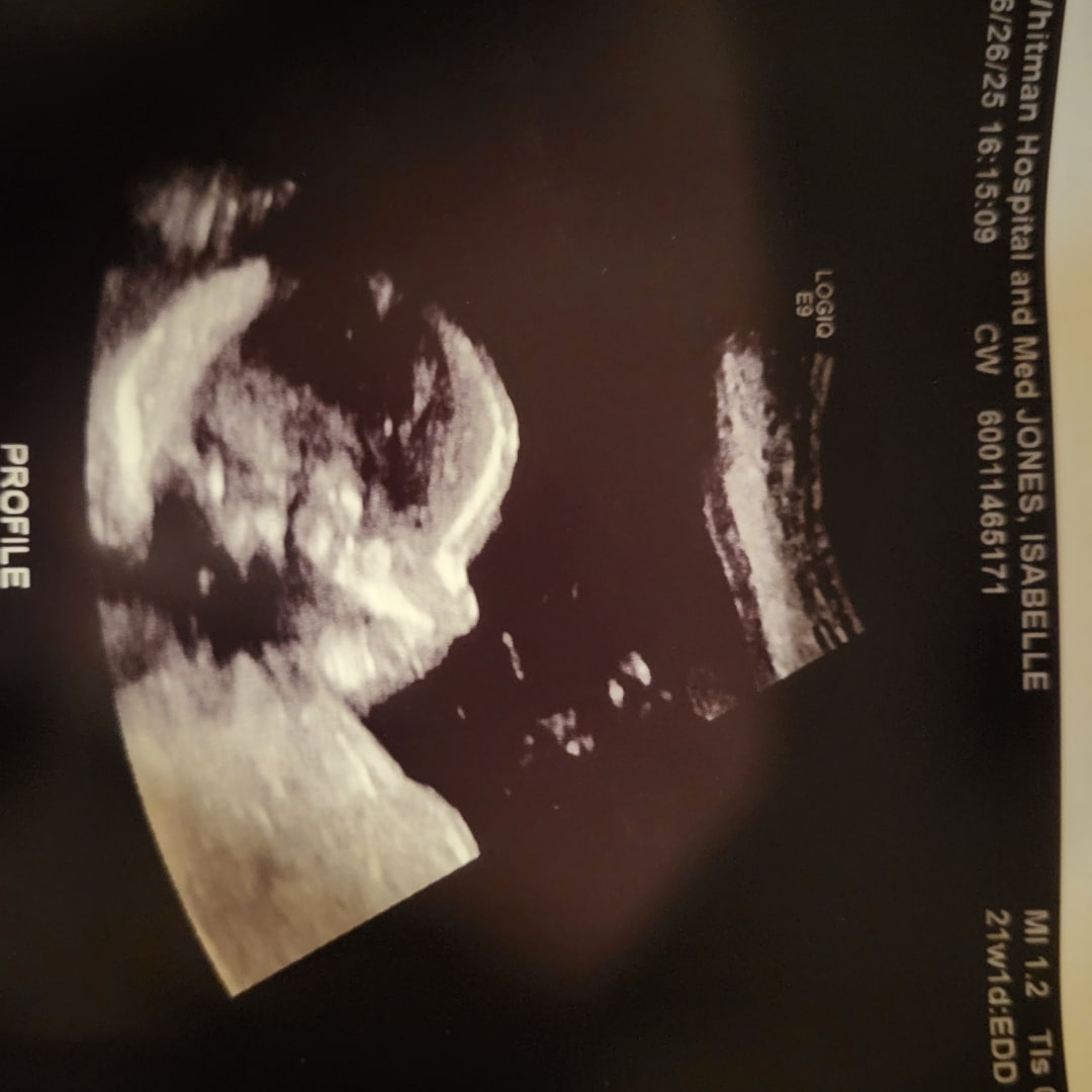 Photo shared by Isabelle for their Babylist baby registry.