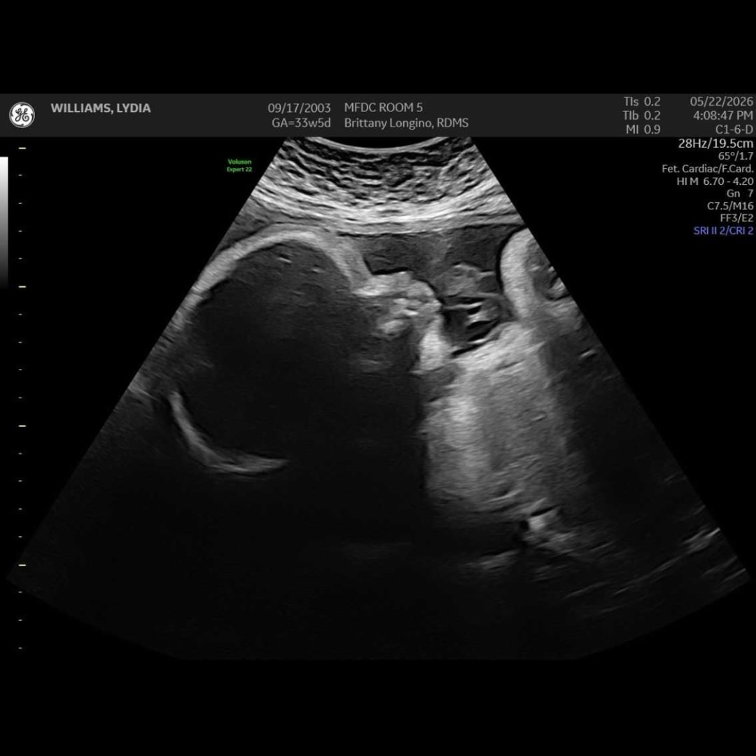 Photo shared by Lydia for their Babylist baby registry.