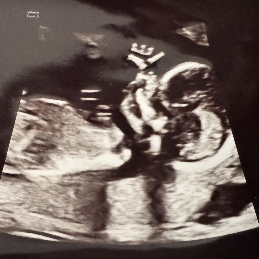 Photo shared by Evelyne for their Babylist baby registry.