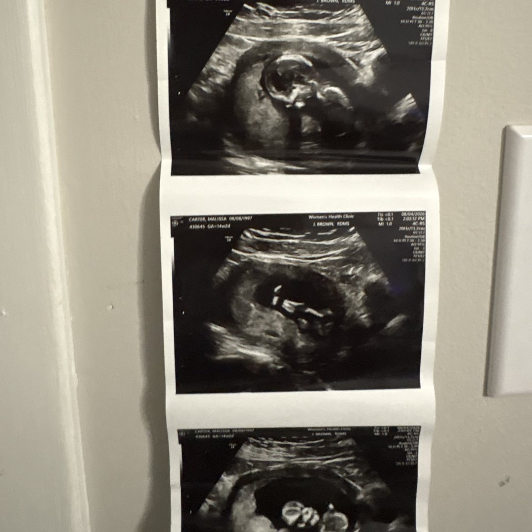 Photo shared by Malissa for their Babylist baby registry.