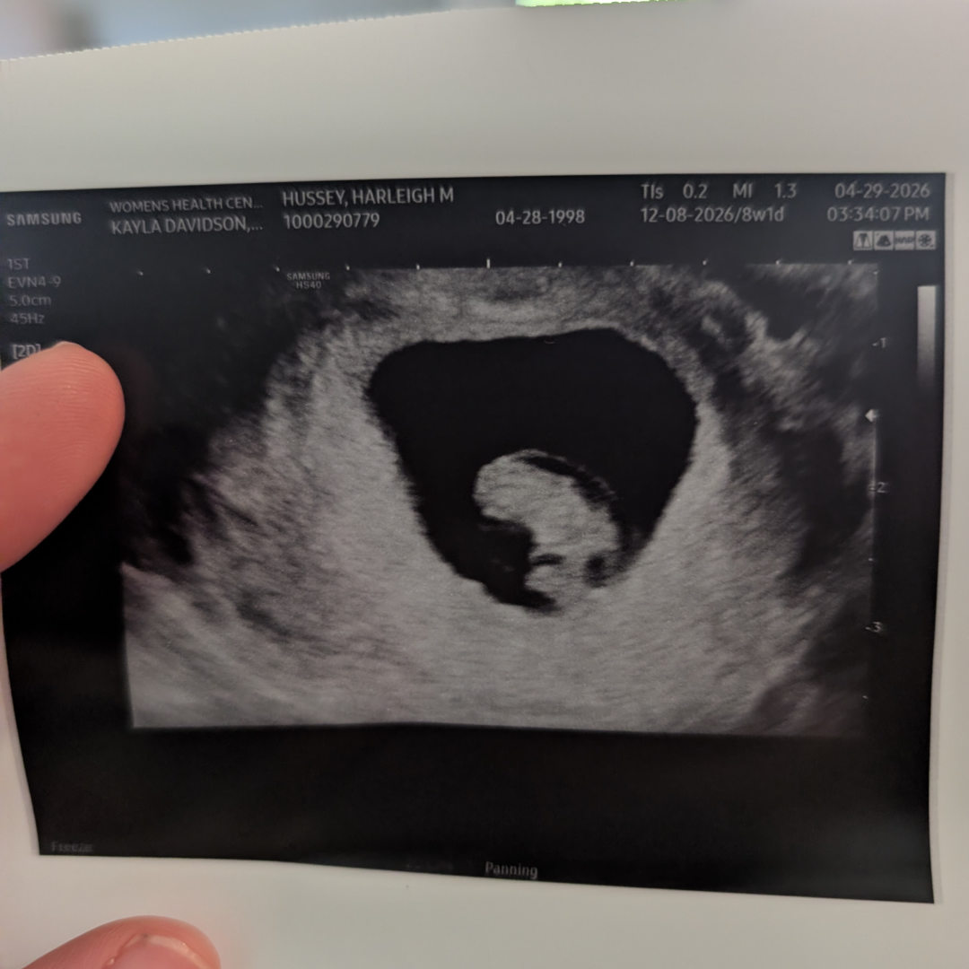 Photo shared by Harleigh for their Babylist baby registry.