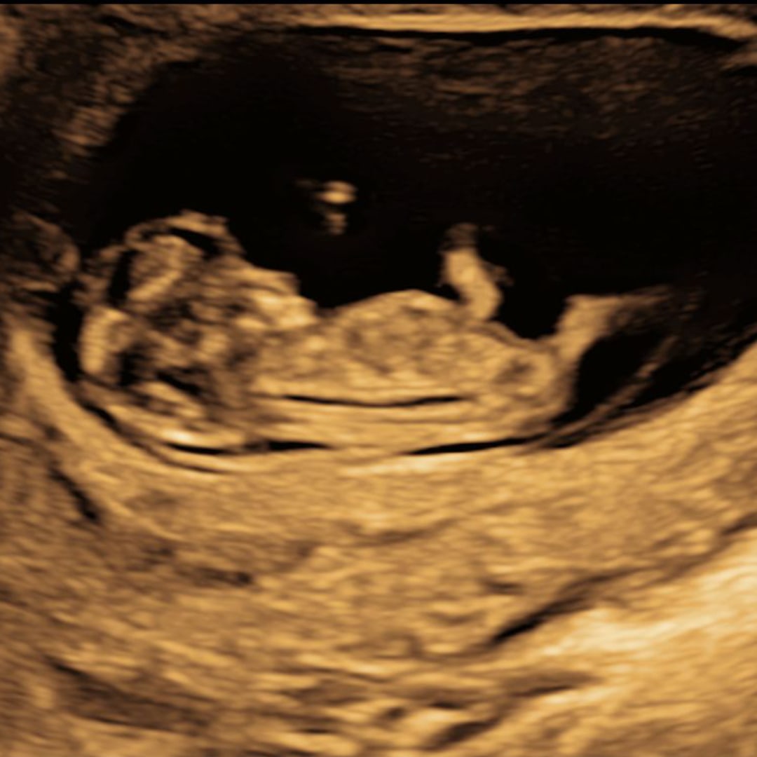 Photo shared by Bailey for their Babylist baby registry.