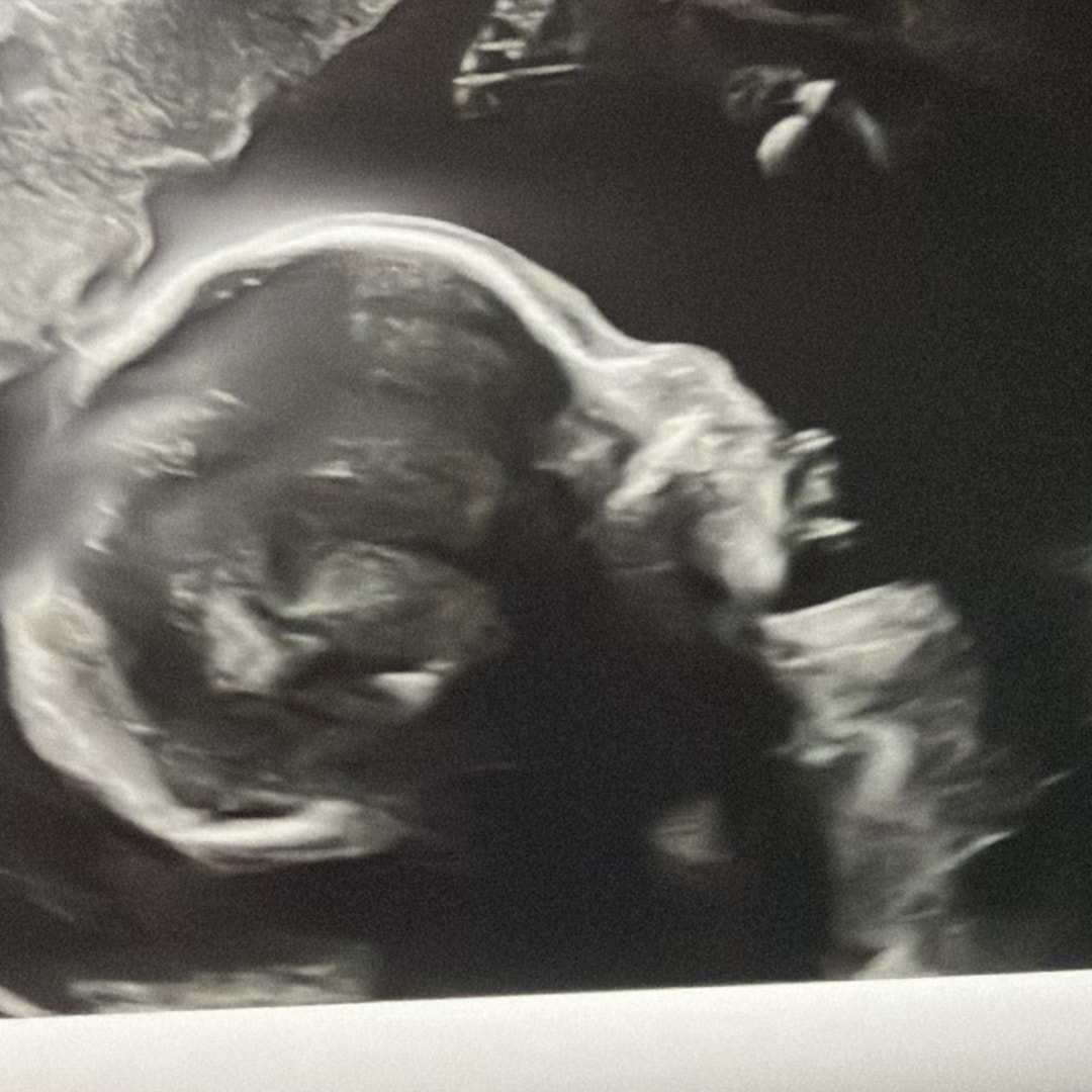 Photo shared by Maddison for their Babylist baby registry.