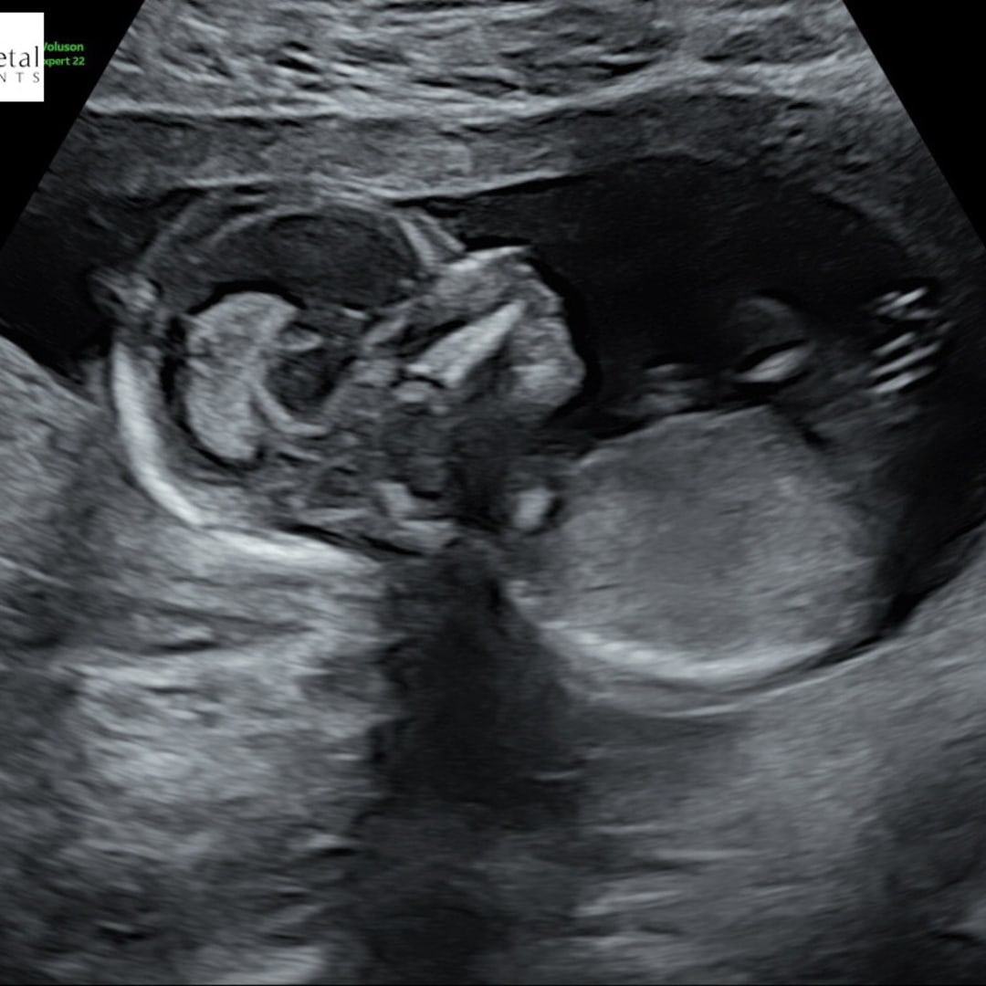 Photo shared by Emma for their Babylist baby registry.