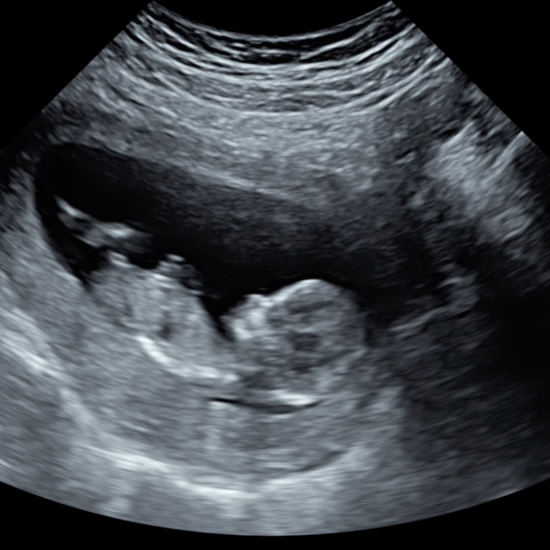 Photo shared by Jemima for their Babylist baby registry.