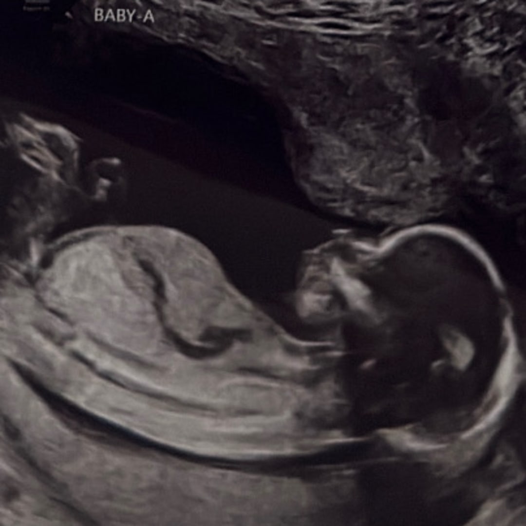 Photo shared by Lily for their Babylist baby registry.