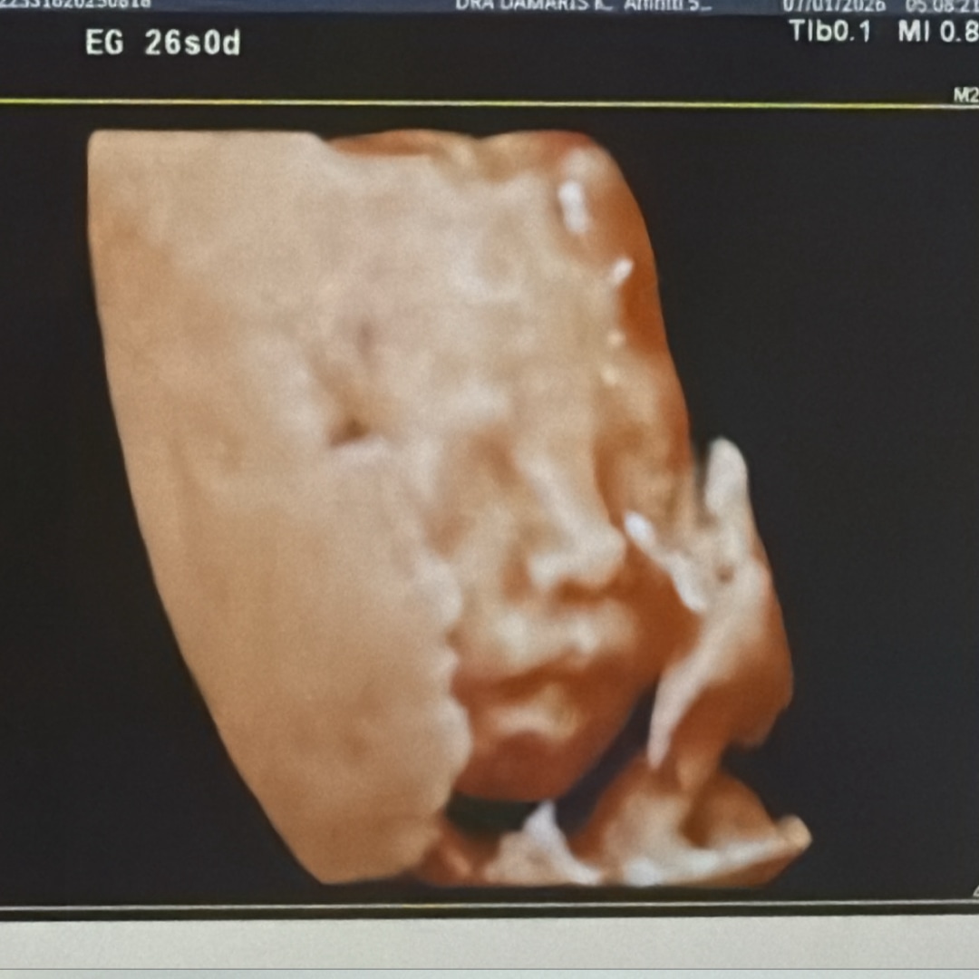 Photo shared by Icel for their Babylist baby registry.