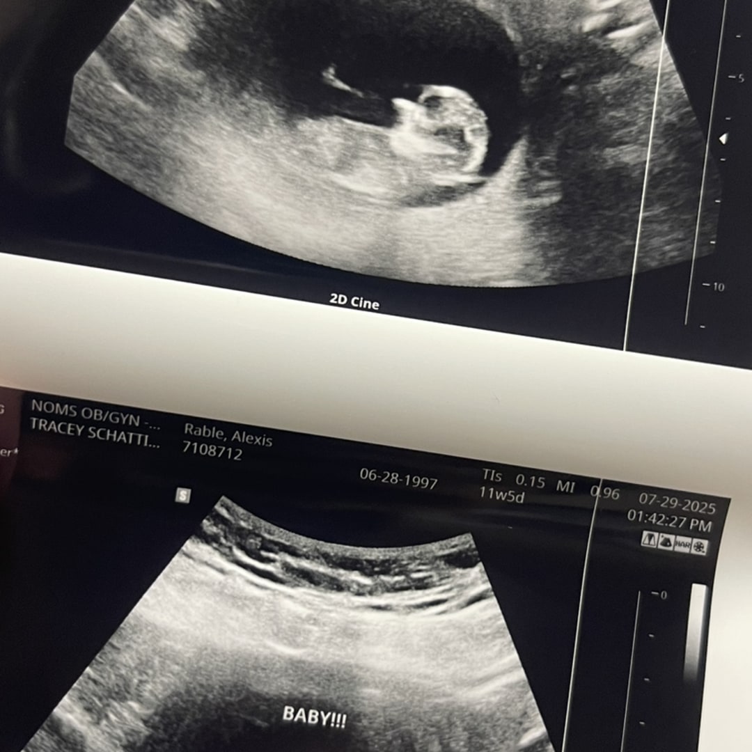 Photo shared by Lex for their Babylist baby registry.