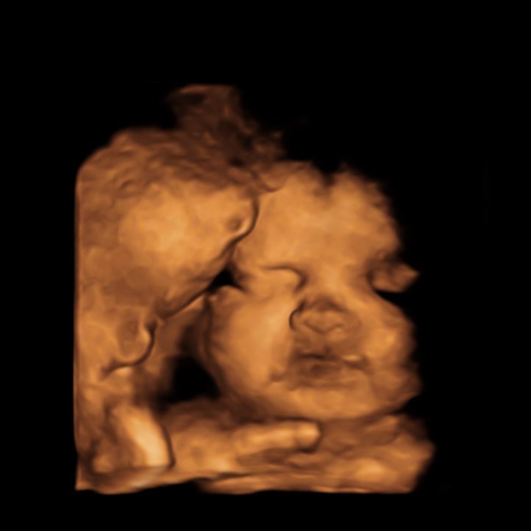Photo shared by Miranda and Devin for their Babylist baby registry.