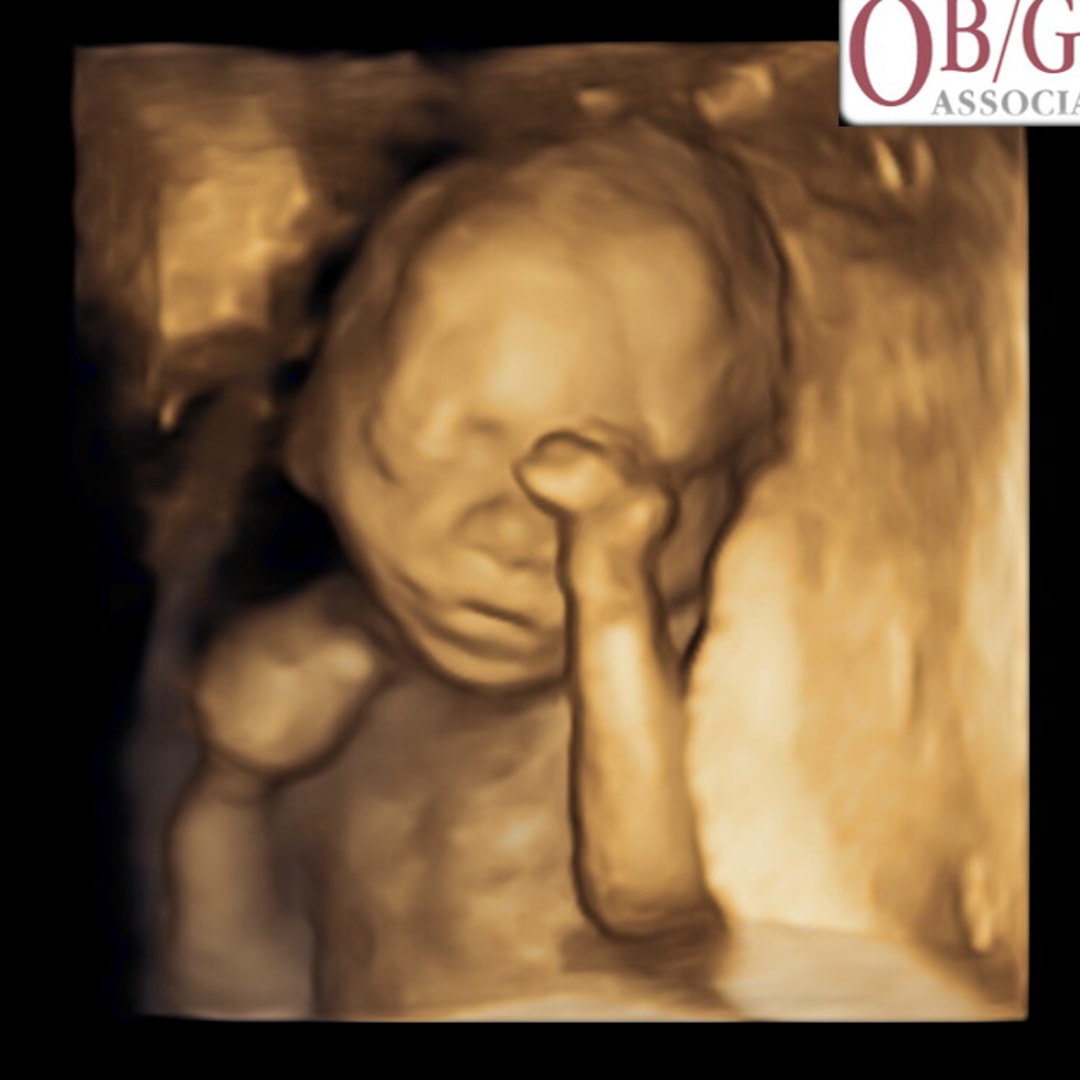 Photo shared by Emilee for their Babylist baby registry.