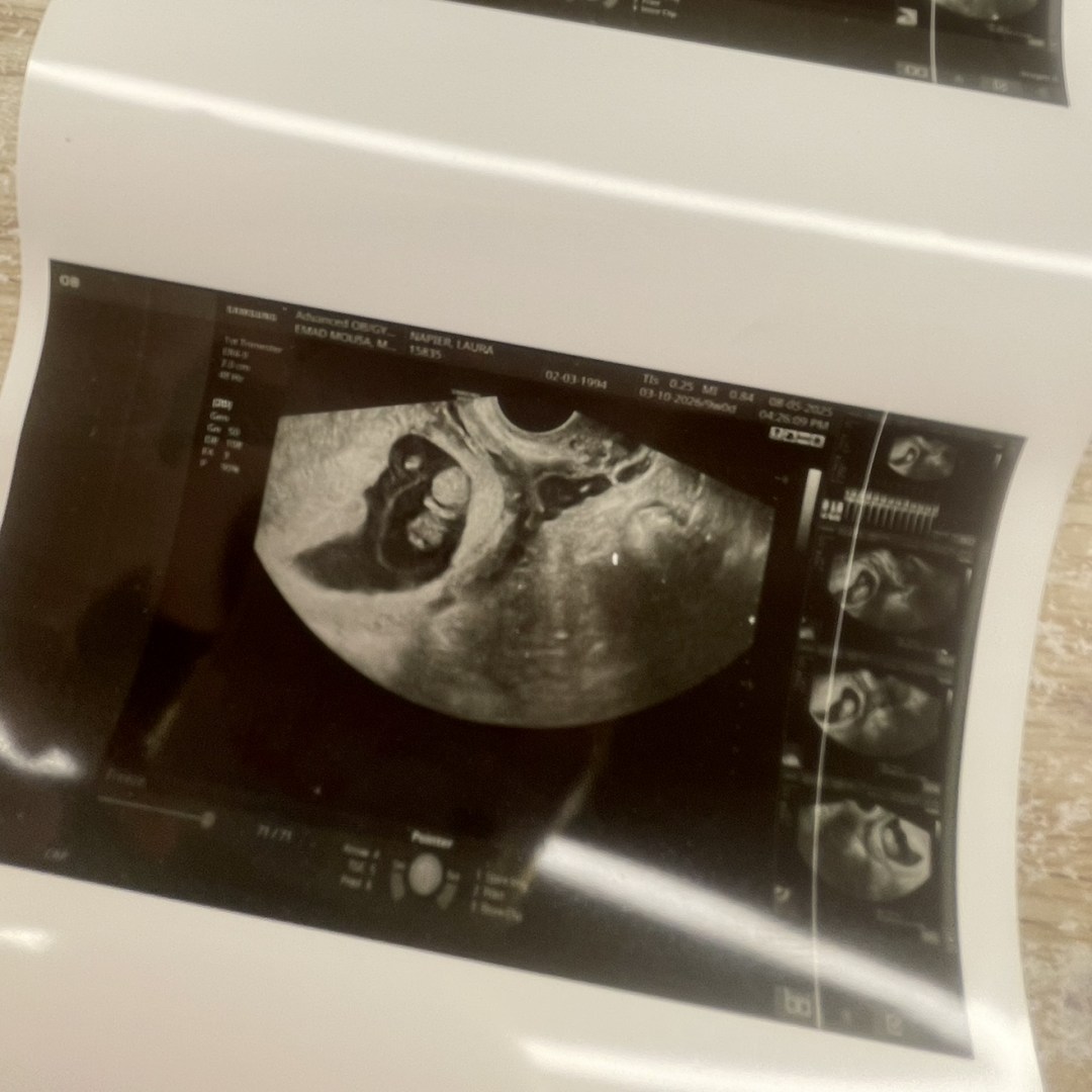 Photo shared by Laura for their Babylist baby registry.