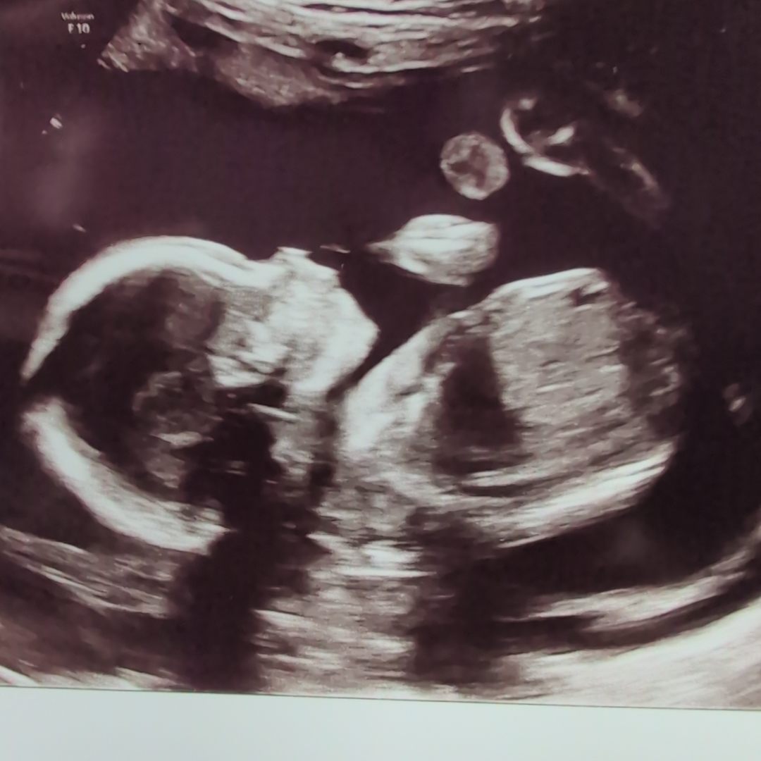 Photo shared by Caroline for their Babylist baby registry.