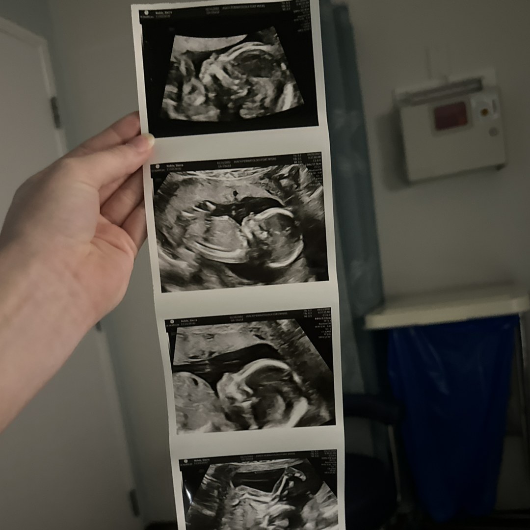 Photo shared by Sierra for their Babylist baby registry.