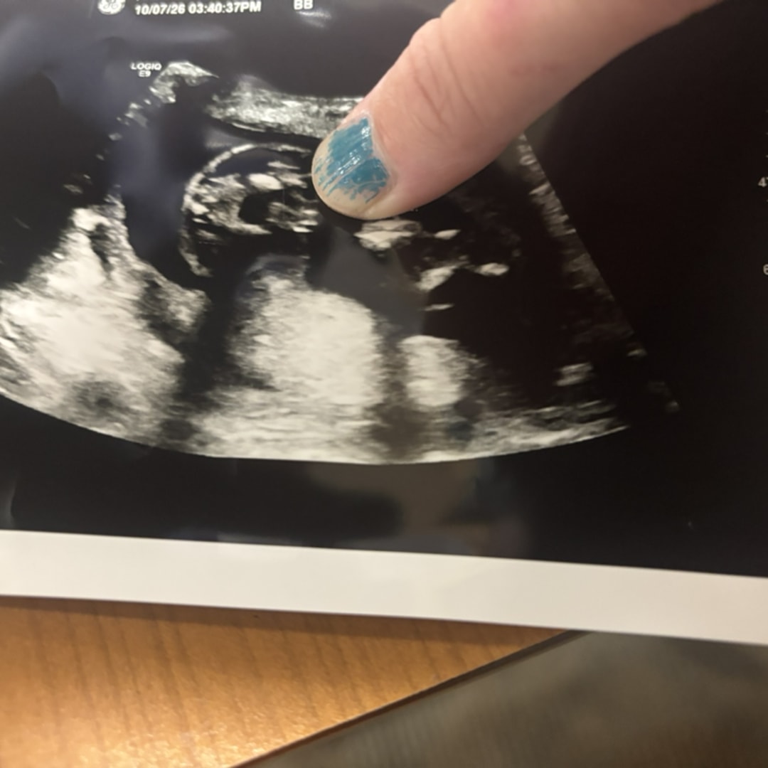 Photo shared by Christina for their Babylist baby registry.