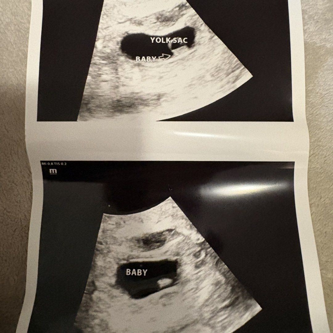 Photo shared by Britni for their Babylist baby registry.
