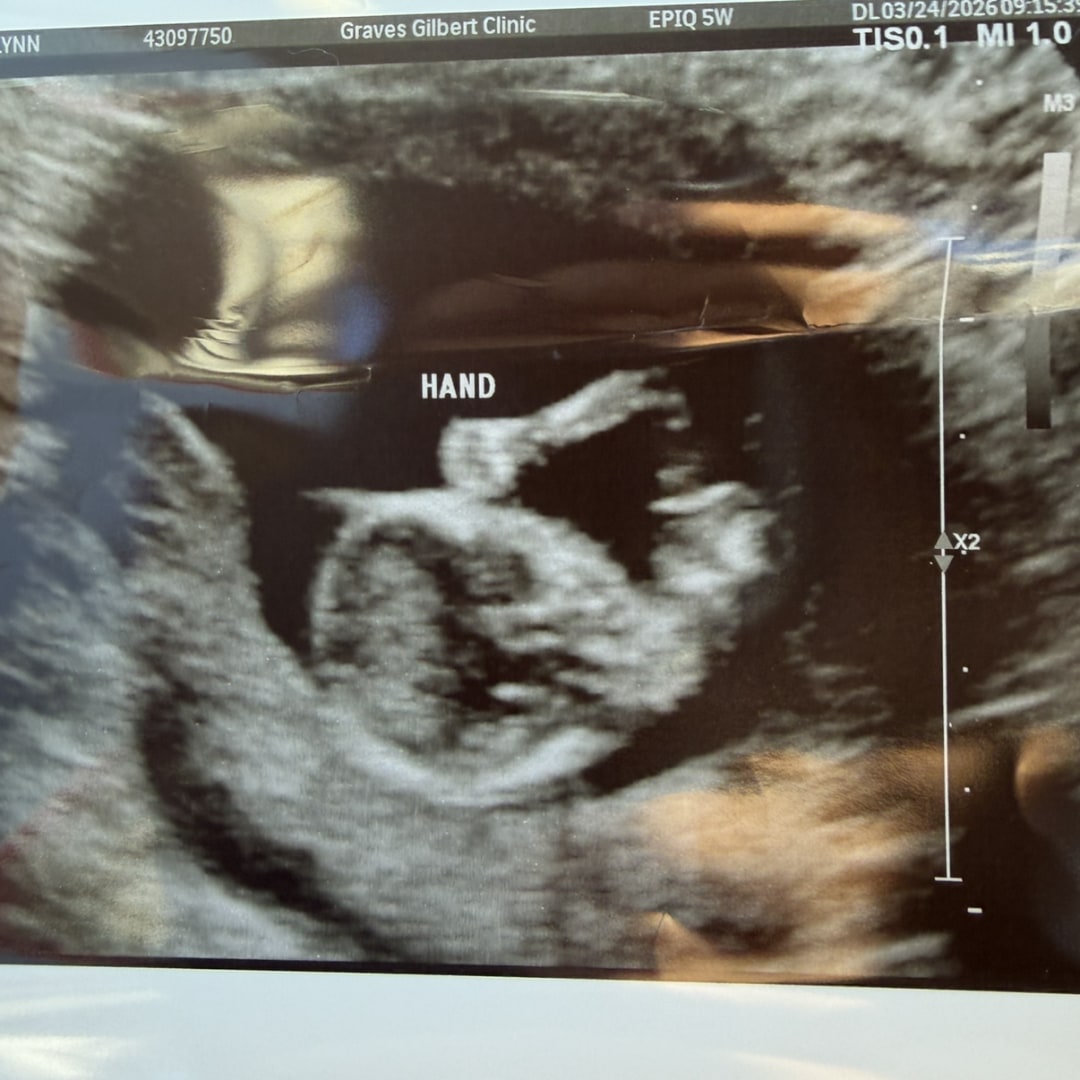 Photo shared by Brooklynn for their Babylist baby registry.