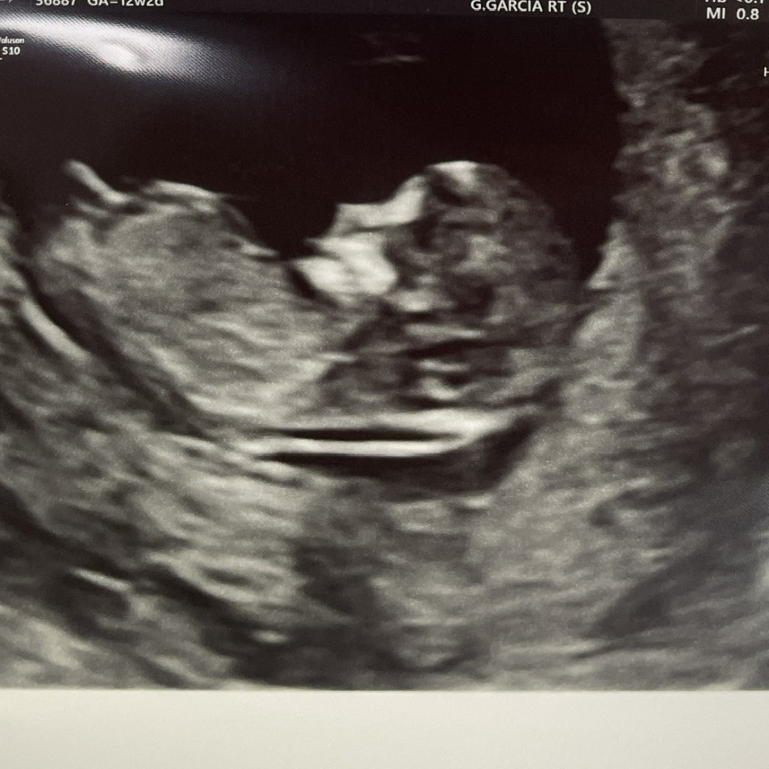 Photo shared by Kelli for their Babylist baby registry.