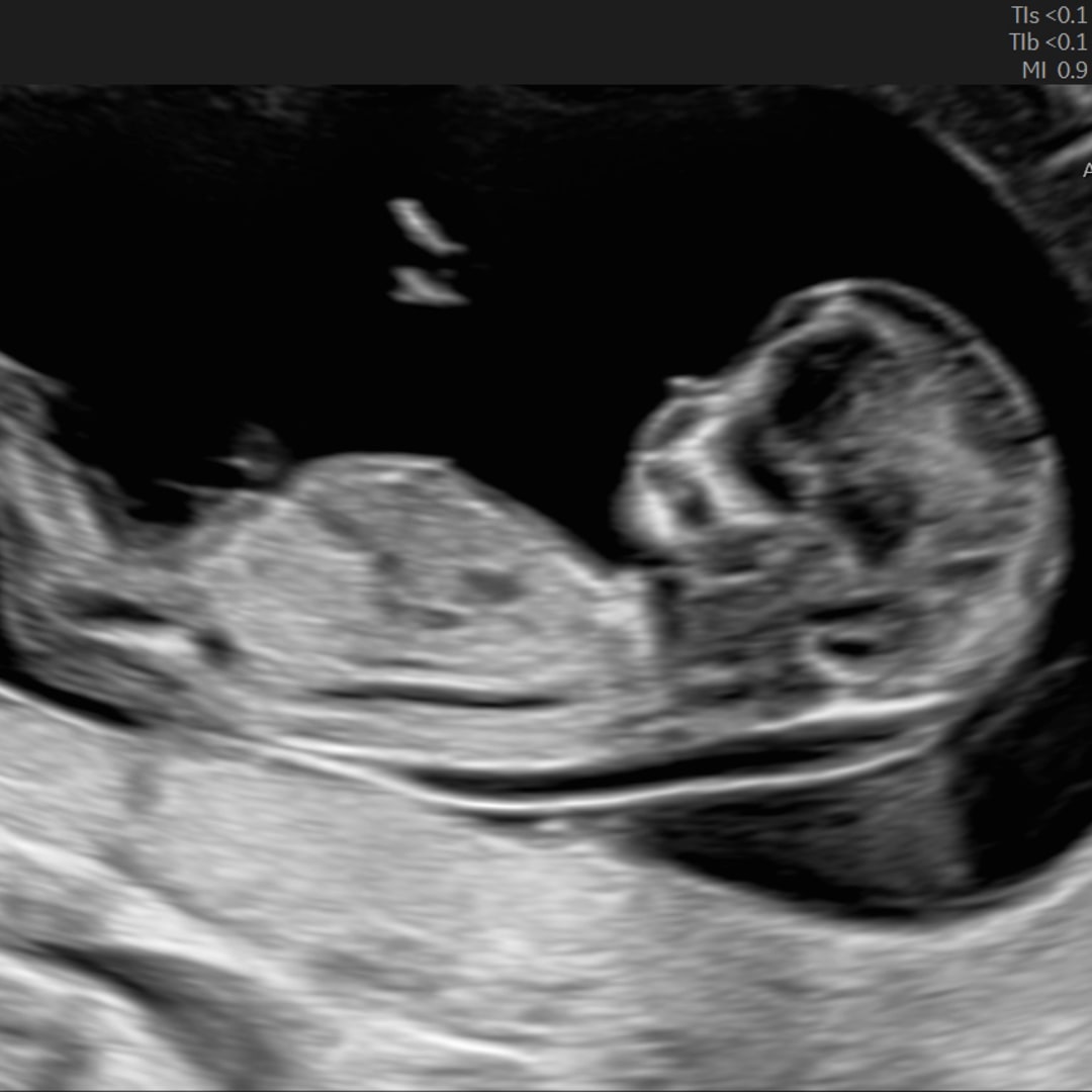 Photo shared by Morgan for their Babylist baby registry.