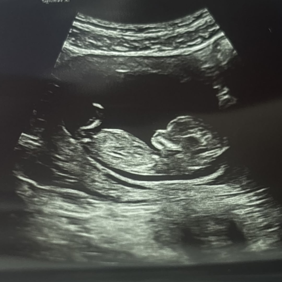 Photo shared by Ella for their Babylist baby registry.