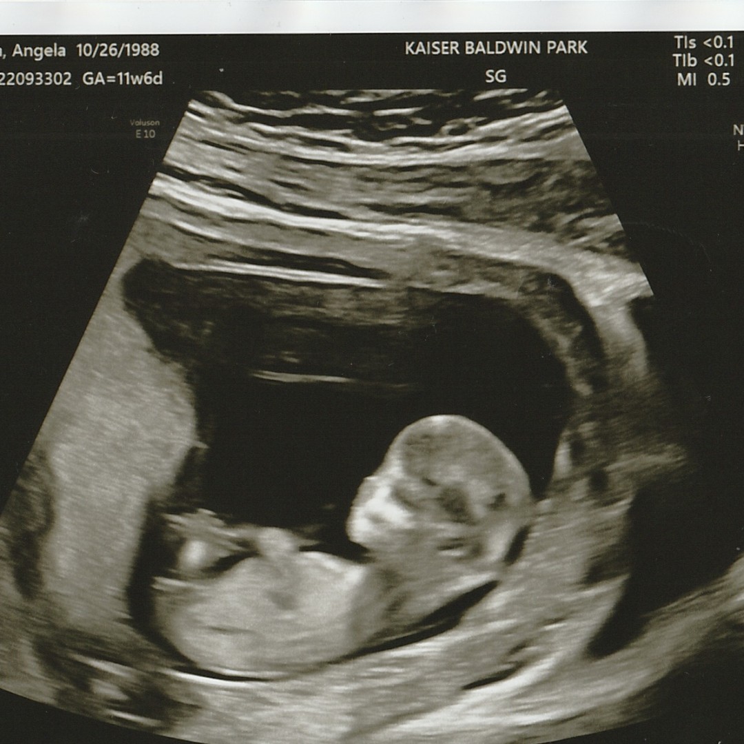 Photo shared by Angela for their Babylist baby registry.