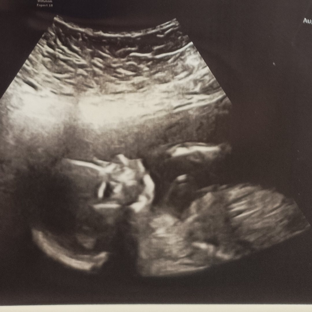 Photo shared by Autumn for their Babylist baby registry.