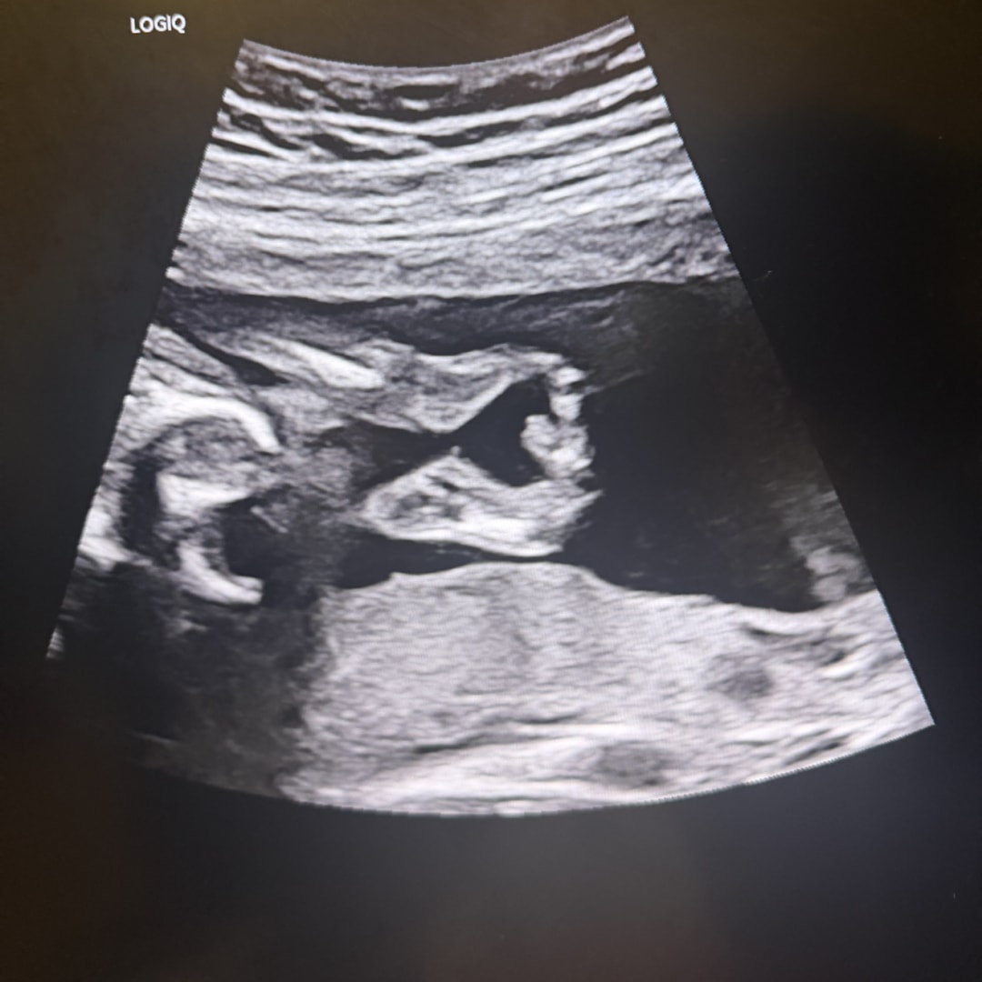 Photo shared by Bethany for their Babylist baby registry.