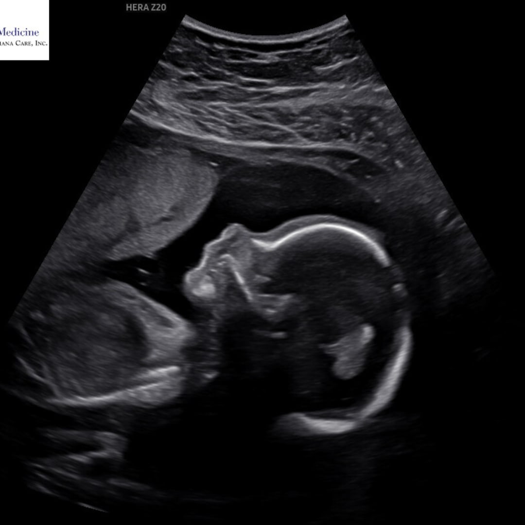 Photo shared by Lexi for their Babylist baby registry.