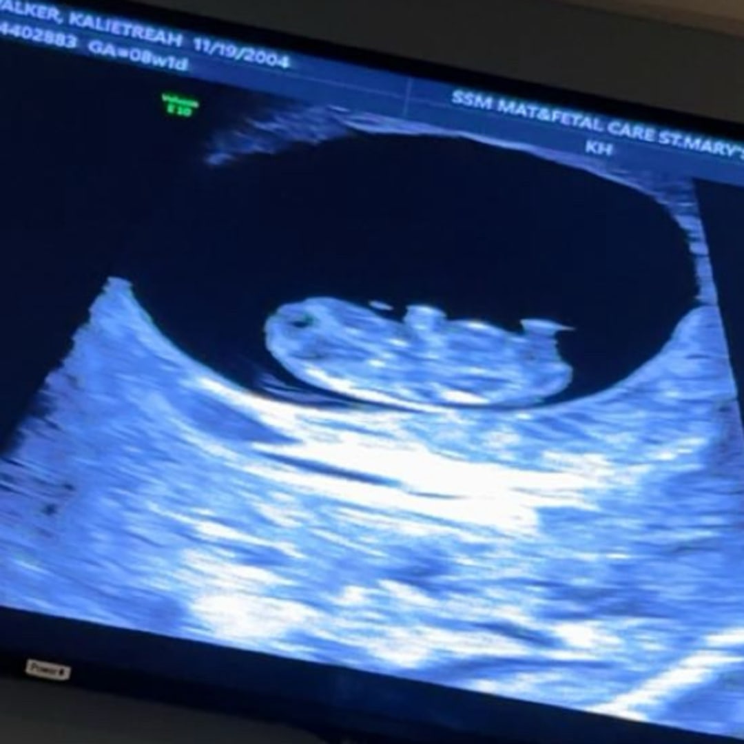 Photo shared by Khamari for their Babylist baby registry.