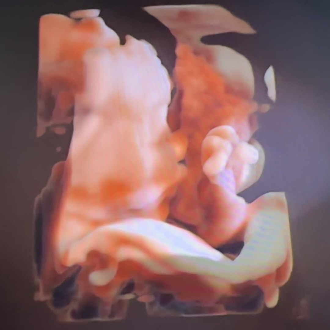 Photo shared by Anjane for their Babylist baby registry.