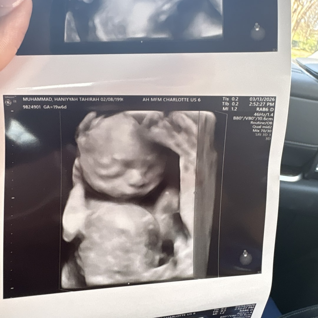 Photo shared by Haniyyah for their Babylist baby registry.