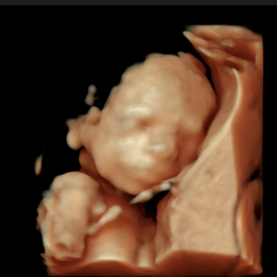 Photo shared by Elaine for their Babylist baby registry.