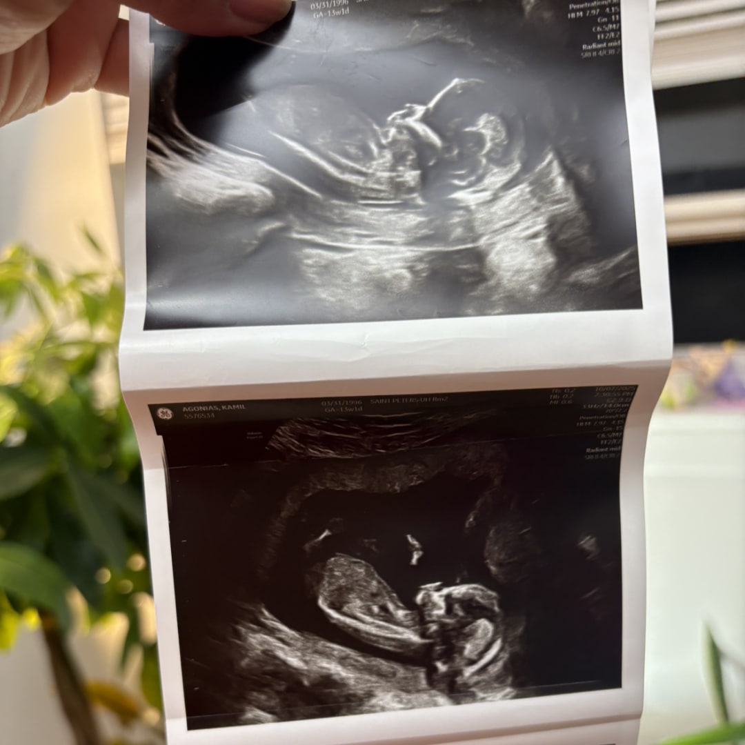 Photo shared by Kamil for their Babylist baby registry.