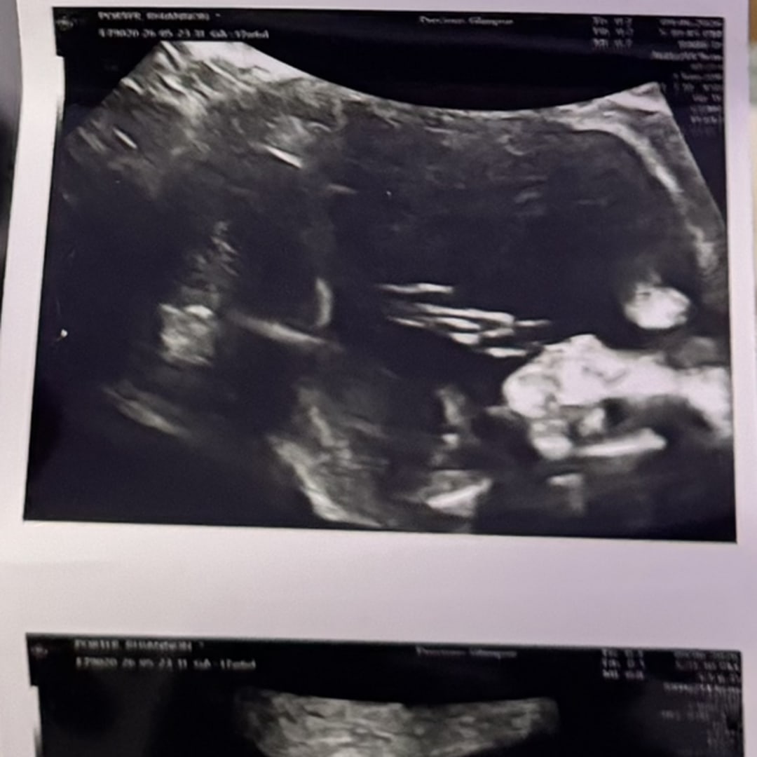 Photo shared by Rhiannon for their Babylist baby registry.