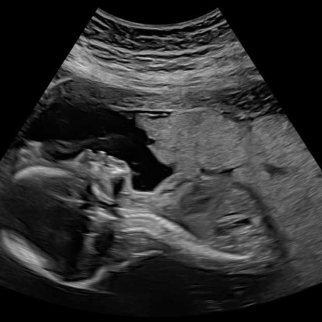 Photo shared by Jerrica for their Babylist baby registry.